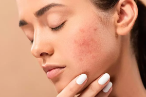 Butylene Glycol and Retinol: How to Use Them Together