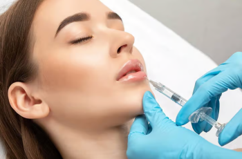Filler Migration in Skincare Treatments: Should You Really Be Concerned?