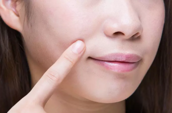 Expert Skincare Tips to Reduce Deep Wrinkles Around the Mouth