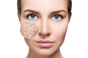 Understanding Dry Skin Types: Find the Right Fix for You
