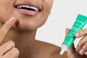 Do Spot Treatments Really Work for Stubborn Acne