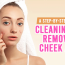 The Dirty Pillow Mistake Ruining Your Face How to Clear Cheek Acne Fast